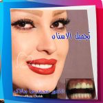 جمال الأسنان (2)