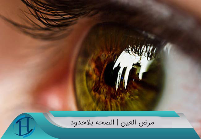 مرض-العين