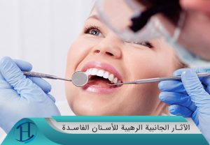 الآثار الجانبية الرهيبة للأسنان الفاسدة