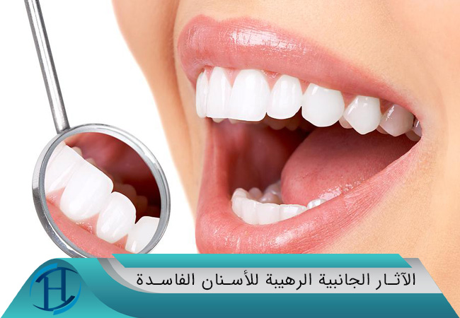 الآثار الجانبية الرهيبة للأسنان الفاسدة