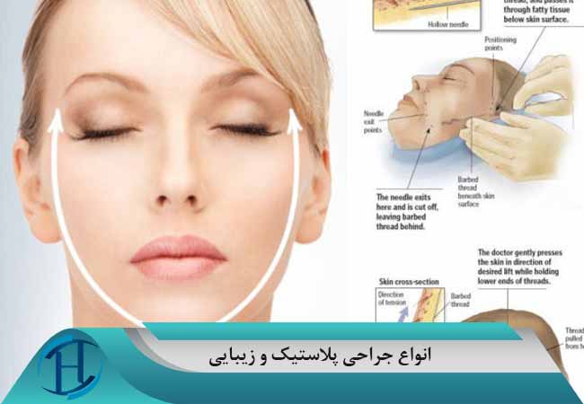 انواع جراحی زیبایی در ایران