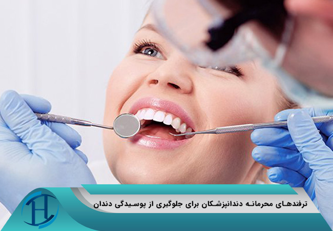 ترفندهای محرمانه دندانپزشکان برای جلوگیری از پوسیدگی دندان