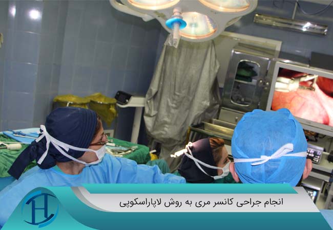 انجام جراحی کانسر مری به روش لاپاراسکوپی توسط دکتر شهریار عزیزی