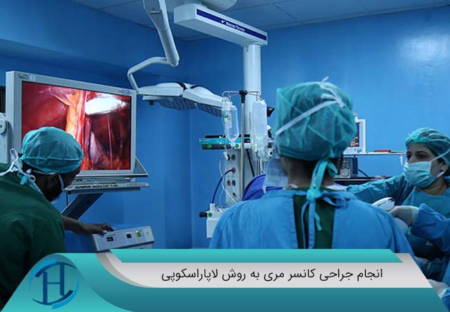 انجام جراحی کانسر مری به روش لاپاراسکوپی توسط دکتر شهریار عزیزی