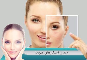 درمان قطعی اسکارهای صورت