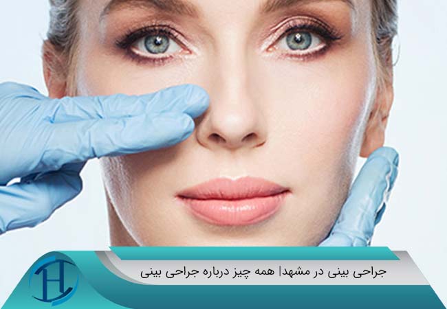 جراحی بینی در مشهد