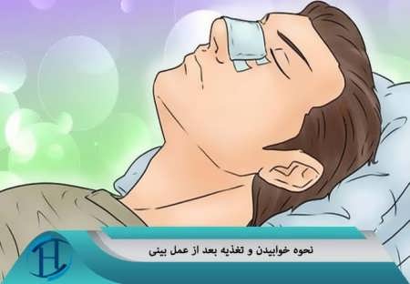 نحوه خوابیدن بعد از عمل بینی 