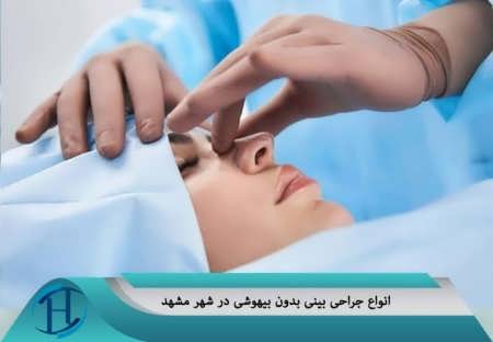 انواع جراحی بینی در مشهد 