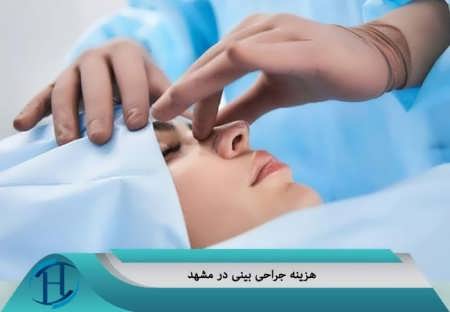 هزینه جراحی بینی در مشهد 